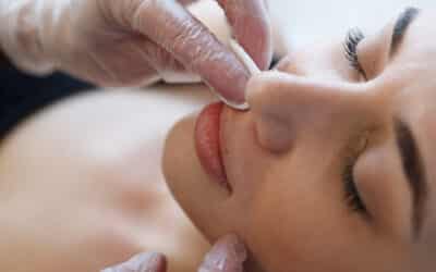 Facial Hair Removal for Women